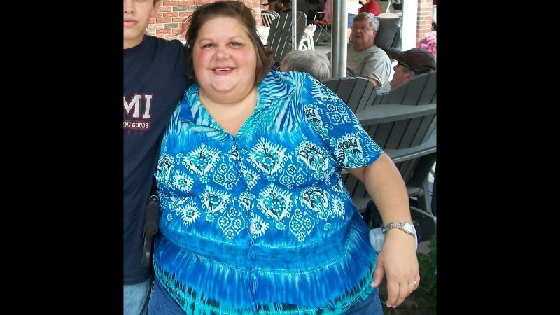 I couldn't walk': Woman loses 276 pounds