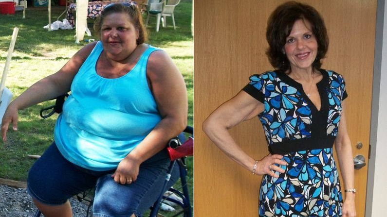 At her heaviest in March 2011, Theresa Borawski weighed 428 pounds. "I could no longer participate in life's activities and was forced to become a spectator while people around me lived their life," she wrote on iReport.com. "Today, <a href="index.php?page=&url=http%3A%2F%2Fwww.cnn.com%2F2013%2F05%2F10%2Fhealth%2Fborawski-weight-loss-irpt%2Findex.html">I am 276 pounds lighter</a>, 14 jean sizes smaller, and no longer need a wheelchair, walker or cane to get around."