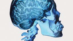 memory implants brain medicine