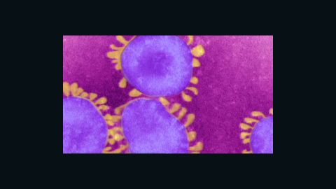 MERS-CoV is a coronavirus, like the one shown above, so-called because it looks like it's surrounded by a crown, or corona.