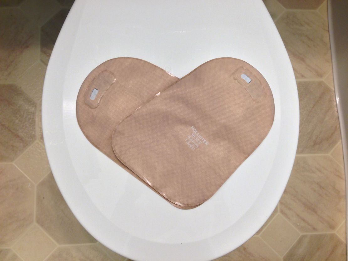 Two ostomy bags form a heart.