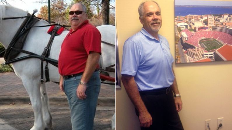 The doctor had flat out told Dale Benzine: "Lose weight or die." Benzine decided to get gastric bypass surgery, reducing his stomach to the size of a golf ball. He's <a href="index.php?page=&url=http%3A%2F%2Fwww.cnn.com%2F2013%2F05%2F17%2Fhealth%2Fdale-benzine-bariatric-surgery%2Findex.html">dropped 130 pounds</a> by eating small, healthy portions multiple times a day. 