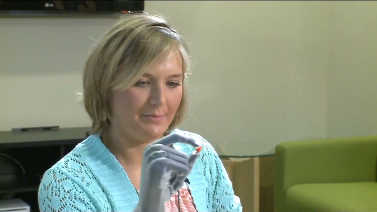 Last year doctors amputated Aimee Copeland's hands, leg and foot after a flesh-eating bacteria threatened her life. This month, she showed off her <a href="http://www.cnn.com/2013/05/17/us/georgia-aimee-copeland/index.html">new bionic hands</a>, which can be positioned using an iPad app. Amputees are living life to the fullest, thanks to advances in prosthetics. From <a href="http://www.cnn.com/2008/TECH/01/25/bluetooth.legs/">computer chips that sync joints</a>, to <a href="http://whatsnext.blogs.cnn.com/2012/03/20/this-week-on-the-next-list-hugh-herr-bionic-man/">Bluetooth devices</a> that coordinate movement, to <a href="http://www.cnn.com/2013/04/18/tech/innovation/david-sengeh-sierra-leone-bionic/index.html">3-D computer models</a> that customize socket designs, new technology has helped these limbs feel as real as possible. 