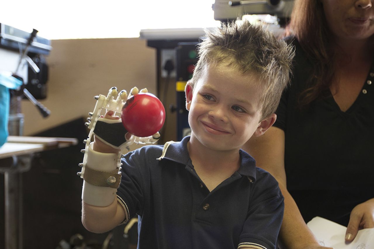 South Africa's Robohand 3-D prints cheap mechanical prosthetic hands, arms and fingers.