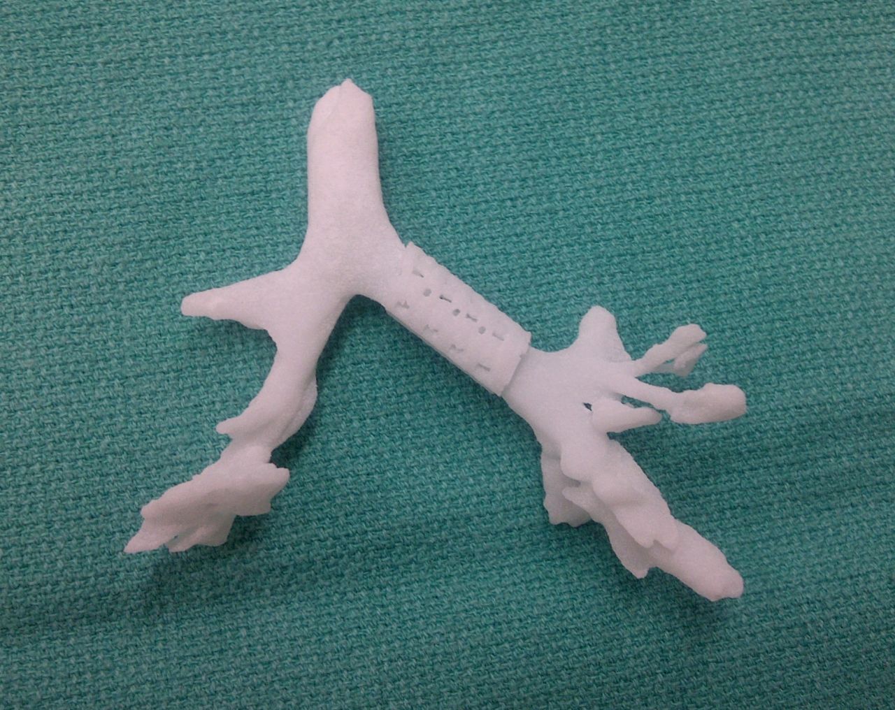 A model of Kaiba's airway, with the biological stent in place.