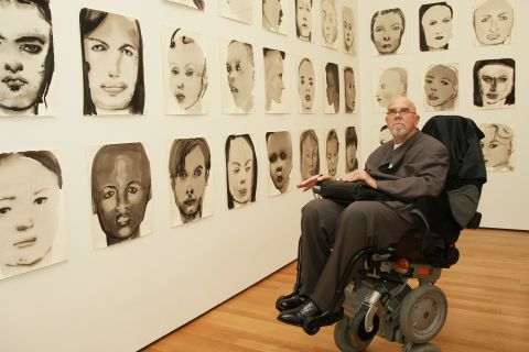 Artist Chuck Close, best known for his giant face portraits, says he suffers from the condition. He said in an <a href="http://www.radiolab.org/blogs/radiolab-blog/2010/jun/15/strangers-in-the-mirror/" target="_blank" target="_blank">interview with RadioLab</a> that he paints faces by dividing a photo up on a grid.
