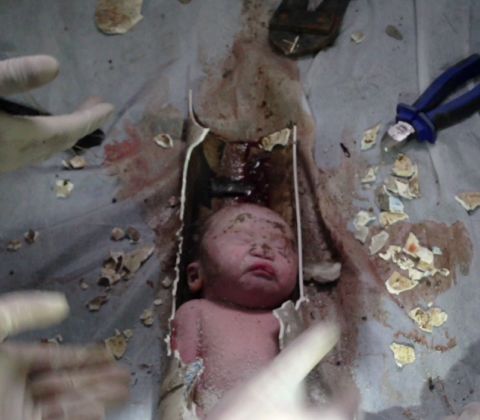 The tiny face of a newborn baby boy is revealed as rescuers cut apart a sewage pipe at a hospital in Jinhua, China, on Saturday, May 25.