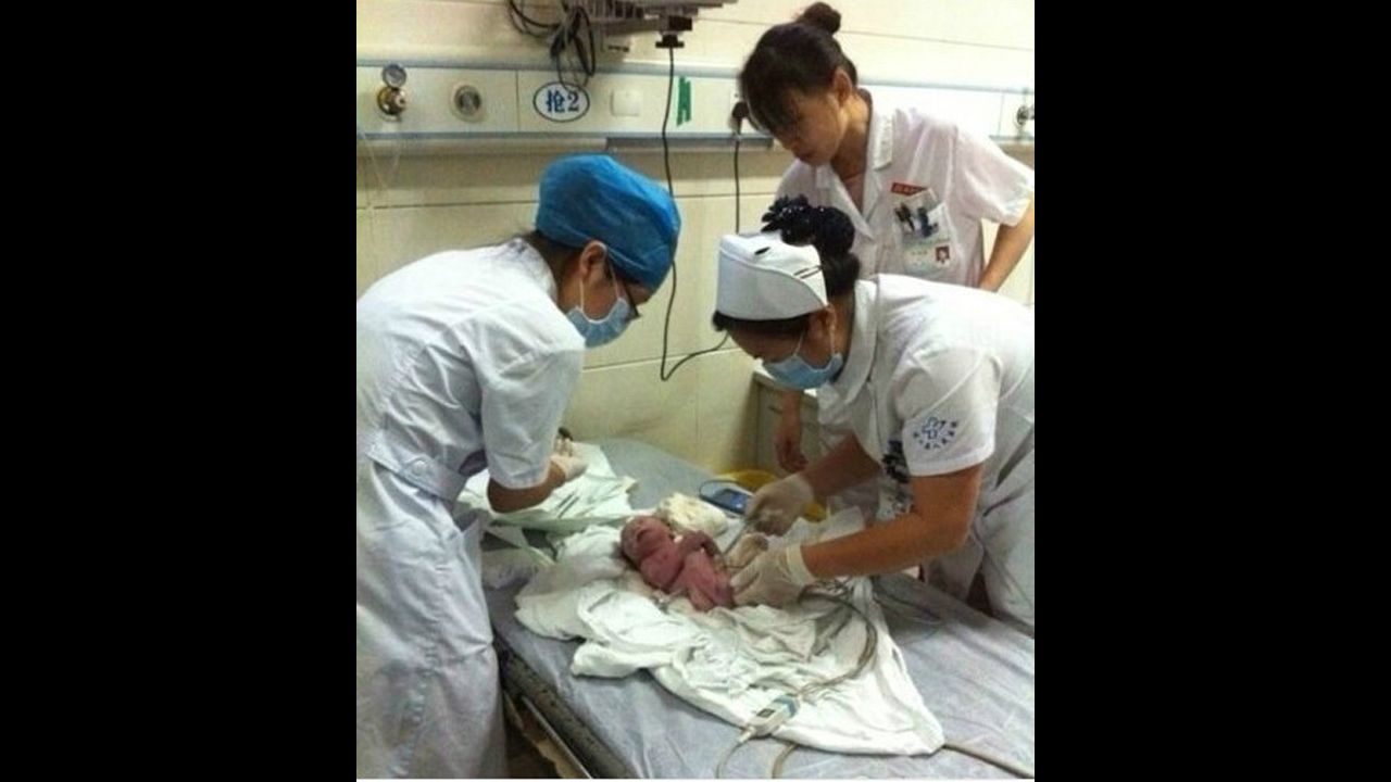 Nurses attend to the infant inside a local hospital.