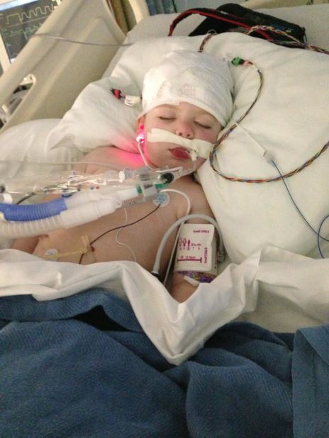 Tripp lies unconscious in the ICU after undergoing one of the several surgeries he endured during his five-month stay at Children's Healthcare of Atlanta.