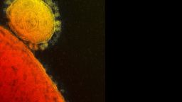 Opinion Why Mers Virus Is So Scary Cnn Opinion Why Mers Virus Is So Scary Cnn