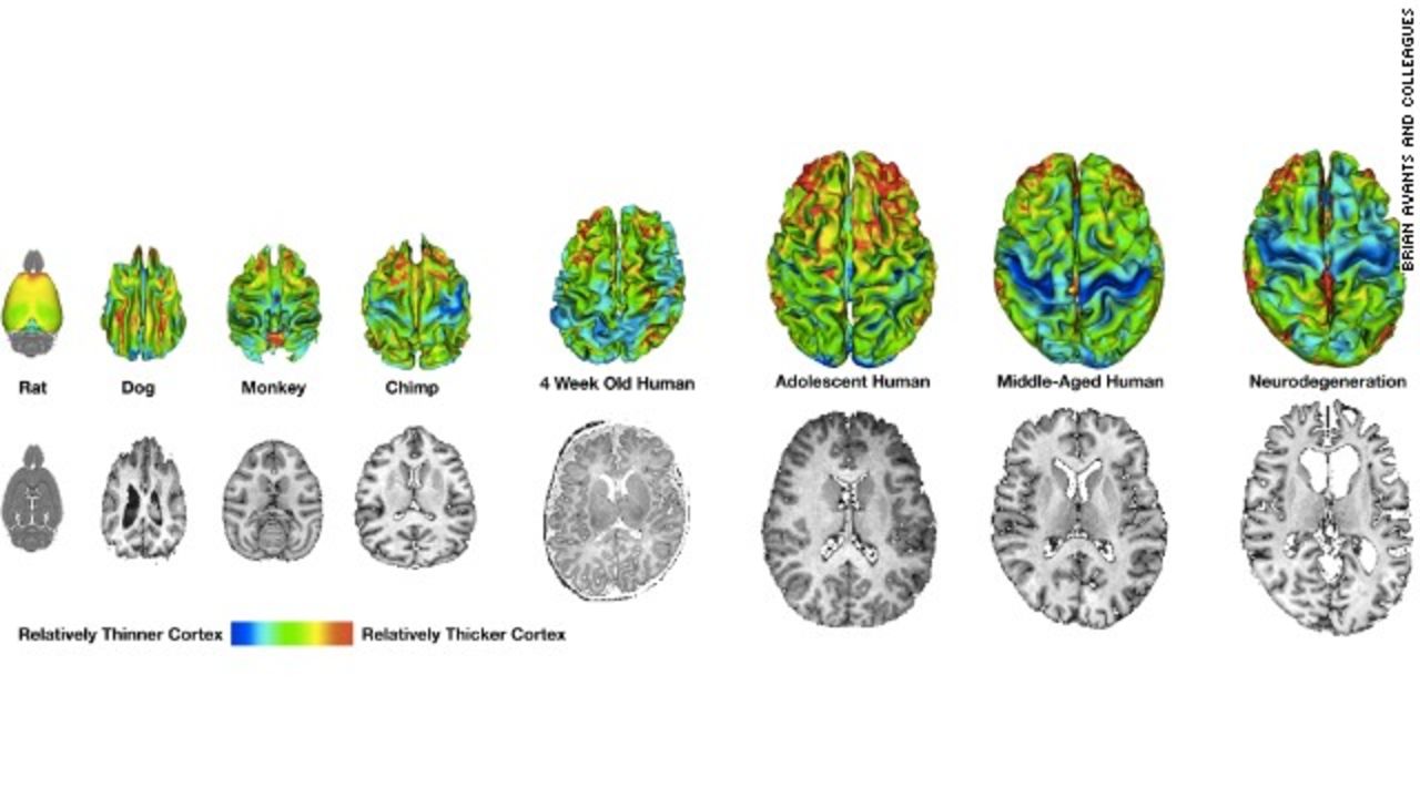 This image, compiled using data from multiple researchers, shows how cortical thickness varies across species. In humans, on the right, there are noticeable changes as a person ages.