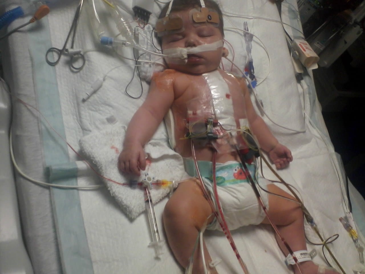 Connor's parents say while they were in the hospital, they asked staff multiple times for information about survival rates, but never got answers.