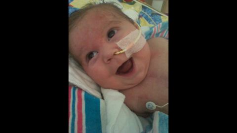Waylon Rainey was born September 13, 2012, with a severe heart defect and underwent a 12-hour surgery at Kentucky Children's Hospital when he was a week old.