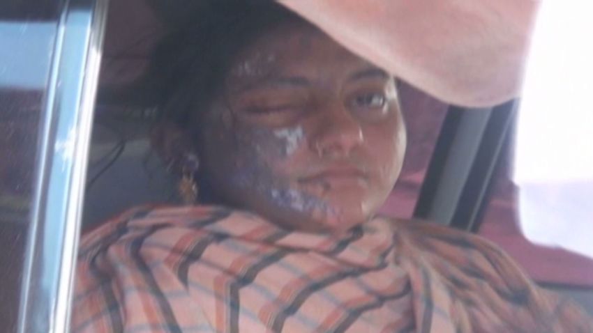 vo pakistan actress acid attack_00003222.jpg