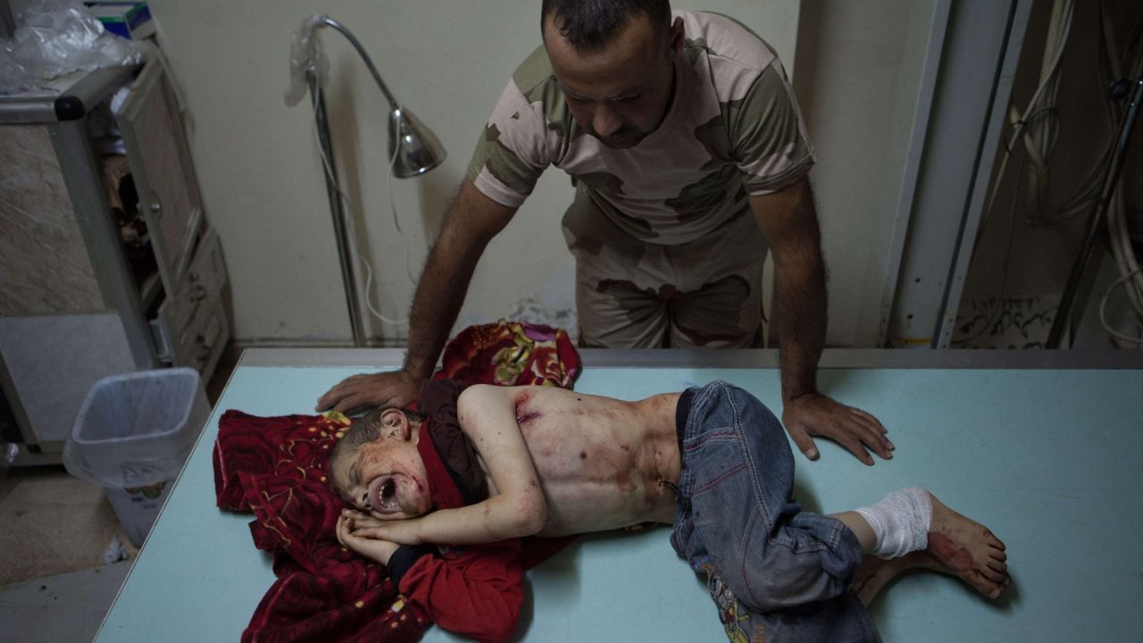 A Free Syrian Army fighter stands over a boy who was injured during shelling in Al-Bara on Monday, July 8. 