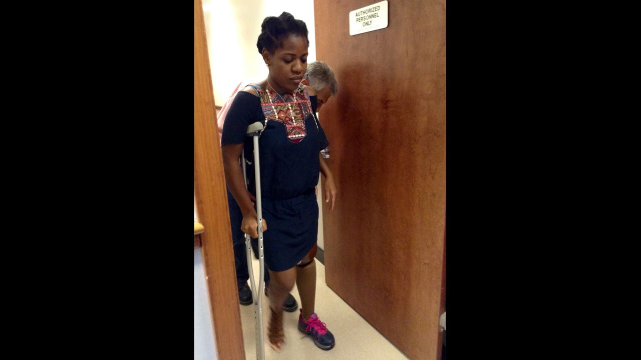 Mery Daniel takes her first steps on her new prosthetic leg on June 26, 2013.