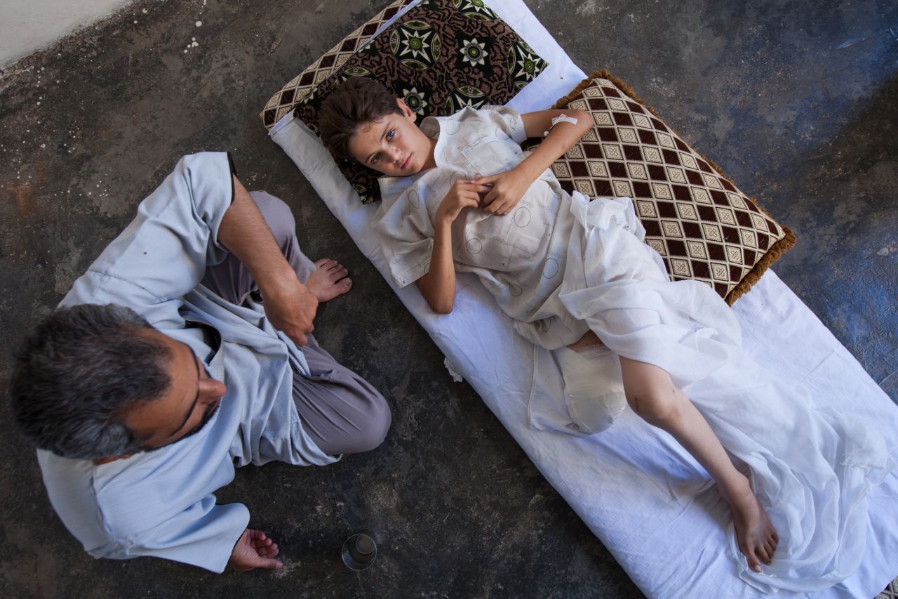 Yahya Sweed, 13, is comforted by his father as he lies on a bed in Kfar Nubul on Tuesday, July 16. The boy was injured by shrapnel, resulting in the amputation of his right leg.