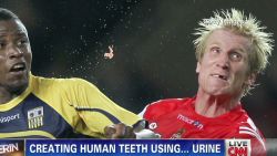 exp erin creating human teeth using urine_00000719.jpg