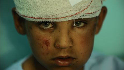 A wounded Afghan boy receives treatment at a local hospital after Taliban attack in Farah province on April 4, 2013. 