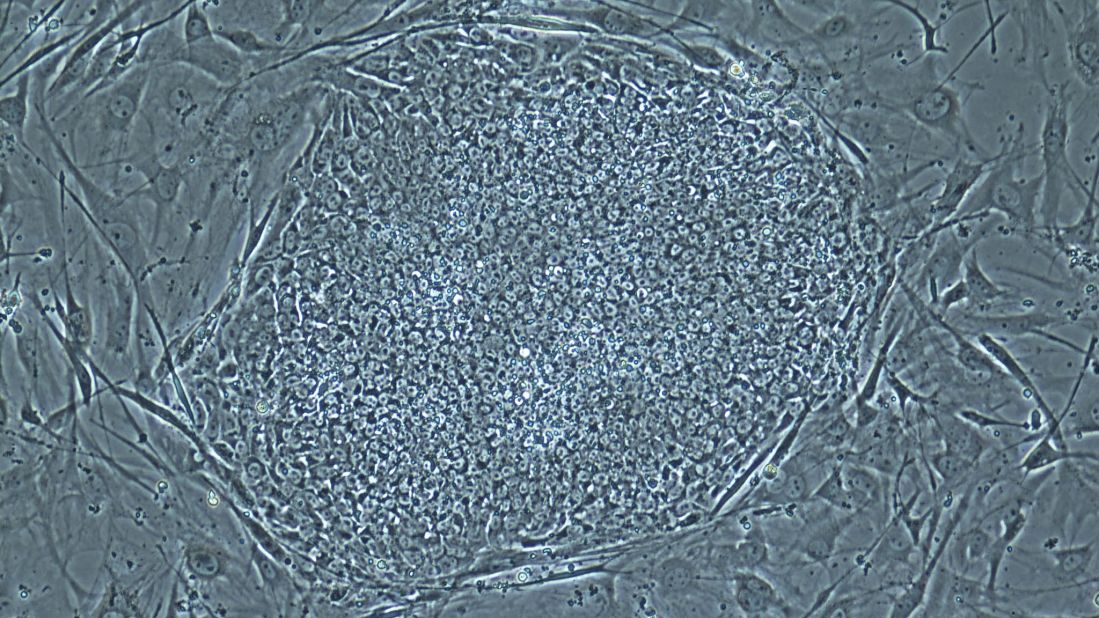 On May 16, 2013, scientists announced that they had, for the first time, produced embryos using skin cells and then used the embryos to make stem cell lines. This technique resembles what was used in cloning Dolly the sheep, but the earlier technique could not have led to a fully cloned human baby. A photo provided by the Oregon Health & Science University shows a stem cell colony produced from human skin cells.