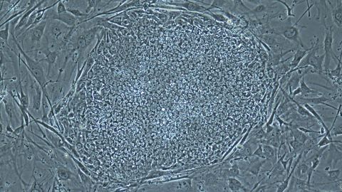 A stem cell colony.
