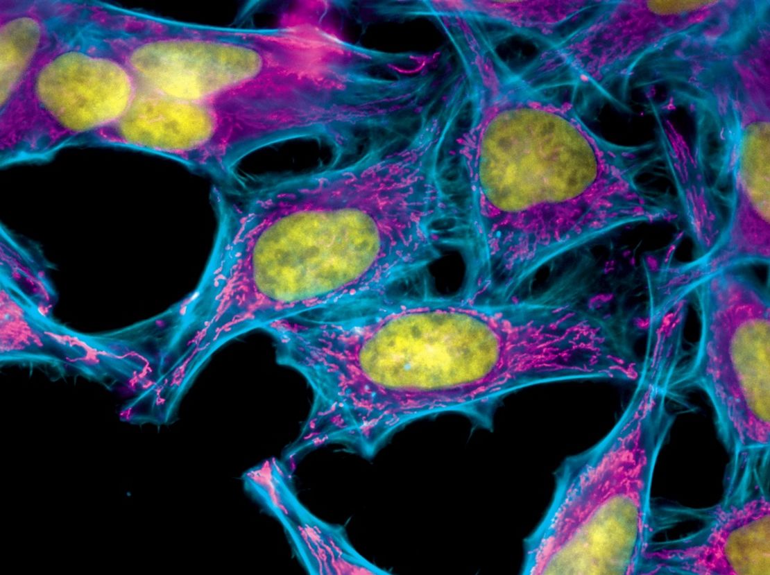 These HeLa cells were stained with special dyes that highlight specific parts of each cell.