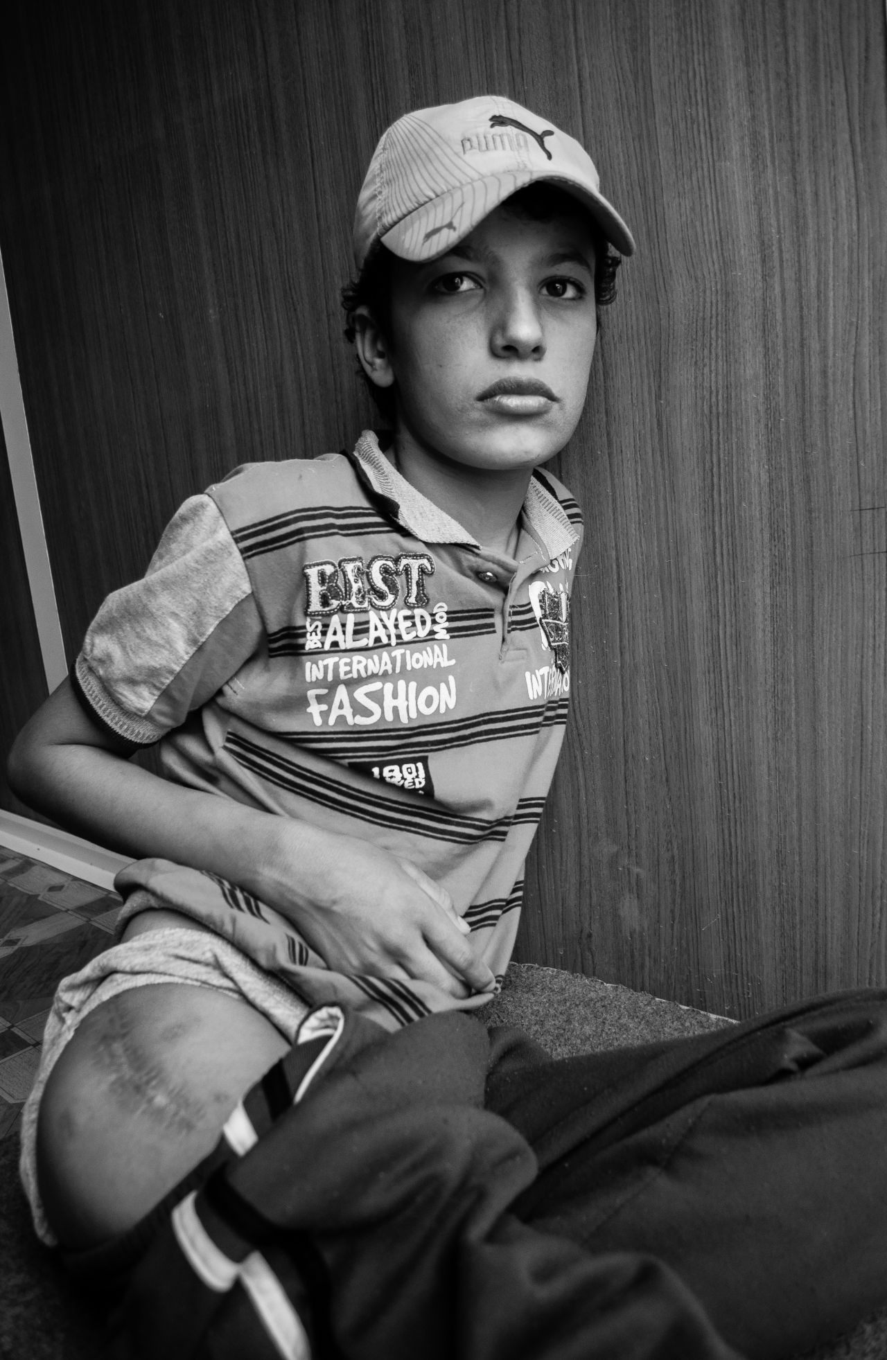 15-year-old Ahmed shows the shrapnel wound on his leg. His mother was killed during the incident.