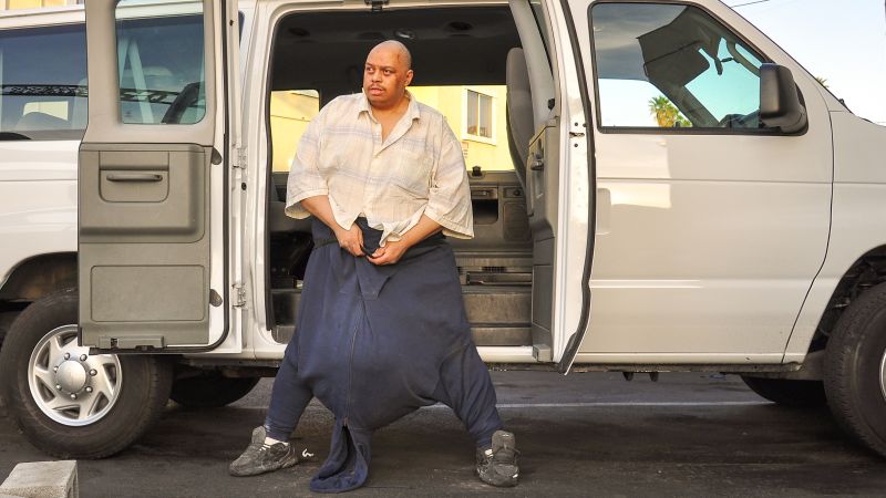 'The man with the 132-pound scrotum': Unraveling the medical mystery | CNN