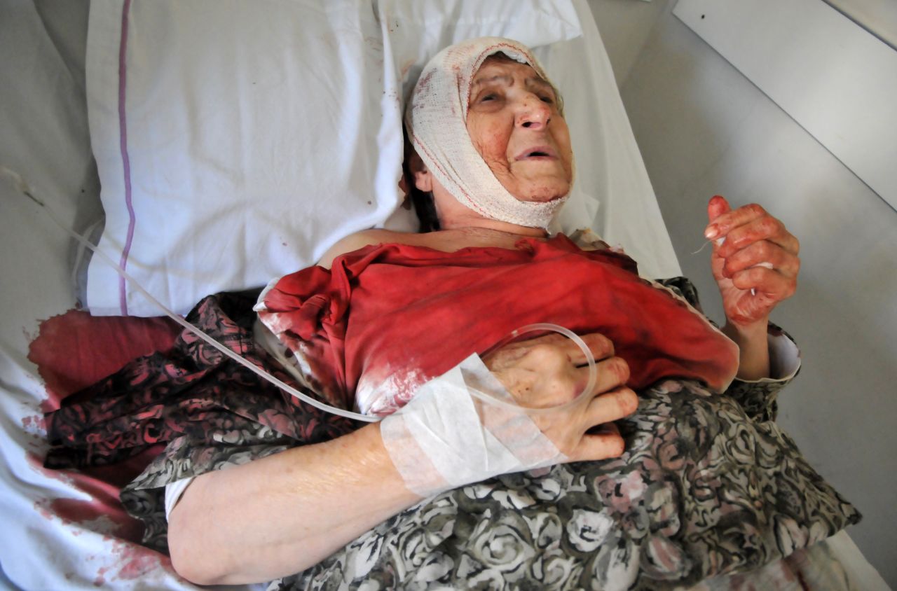 A woman rests after being injured by a blast in Tripoli.