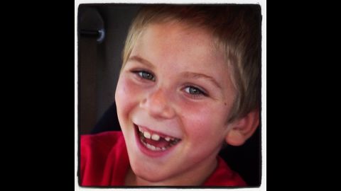 Riley, 8, suffers from epilepsy and is non-verbal.