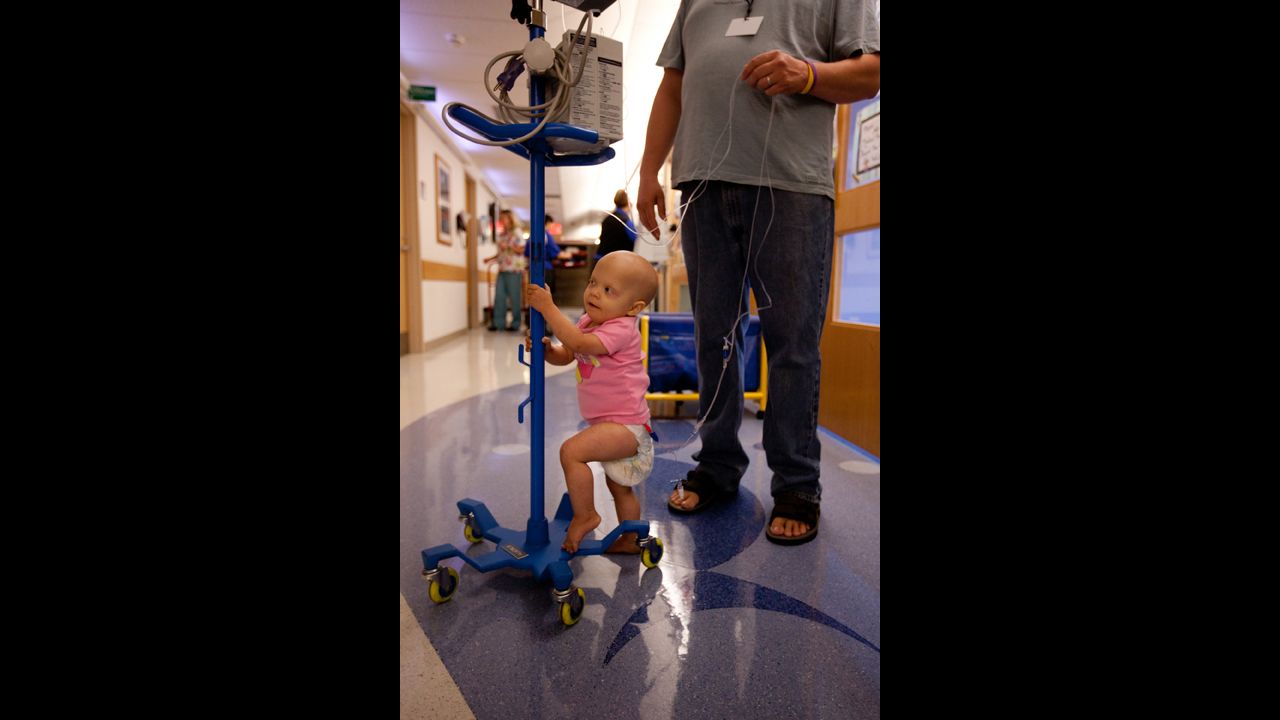 In April 2011, Saoirse's parents noticed she had two black eyes. She was also cranky and vomiting. Doctors later found a neuroblastoma tumor in the toddler's abdomen. Her cancer was stage four.