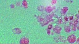 Brain-eating amoeba, which killed a boy in Lousiana in August, have been detected in DeSoto Parish's water supply.
