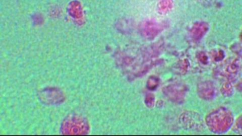 Brain-eating amoeba, which killed a boy in Lousiana in August, have been detected in DeSoto Parish's water supply.