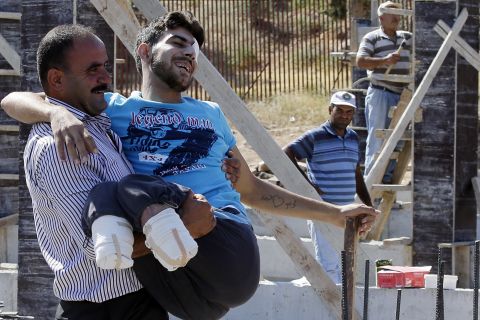 Mustafa Abu Bekir, who was wounded while fighting with the Free Syrian Army, smiles as he meets relatives after crossing the Cilvegozu gate border in Turkey's Hatay province in September 2013.