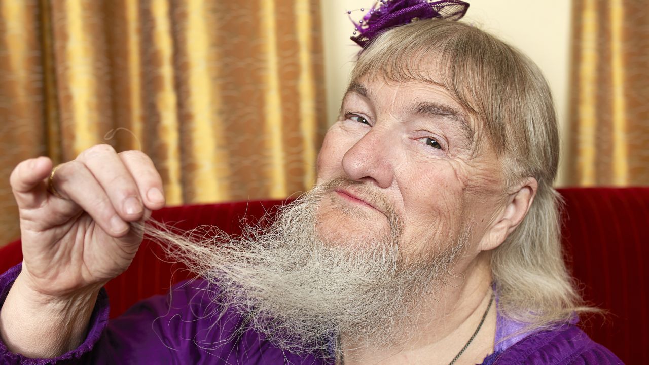 Estos récords aparecen en el libro Guinness 2014 que se publicó el 10 de septiembre. La mujer con la barba más larga pertenece a Vivian Wheeler de Estados Unidos, con una longitud de 25,5 cm desde el folículo a la punta del pelo medida el 8 de abril de 2011.