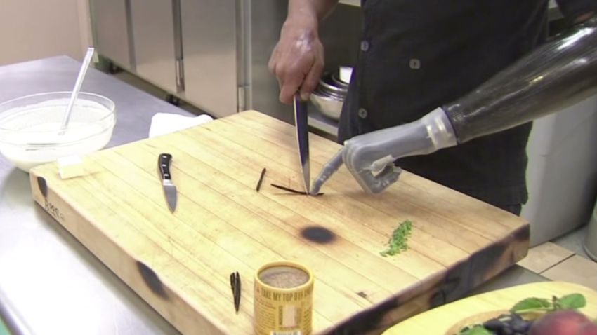 dnt or chef with bionic hand _00001623.jpg