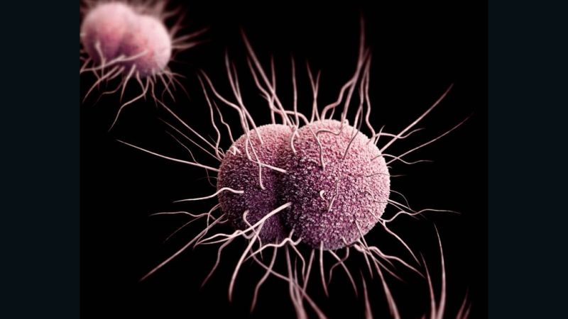 New antibiotic is effective against gonorrhea, could be first new treatment since 1990s, study says | CNN