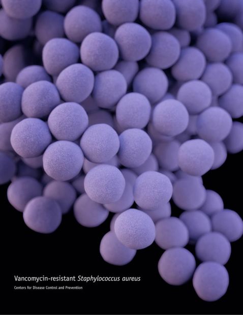 Vancomycin-resistant Staphylococcus aureus
