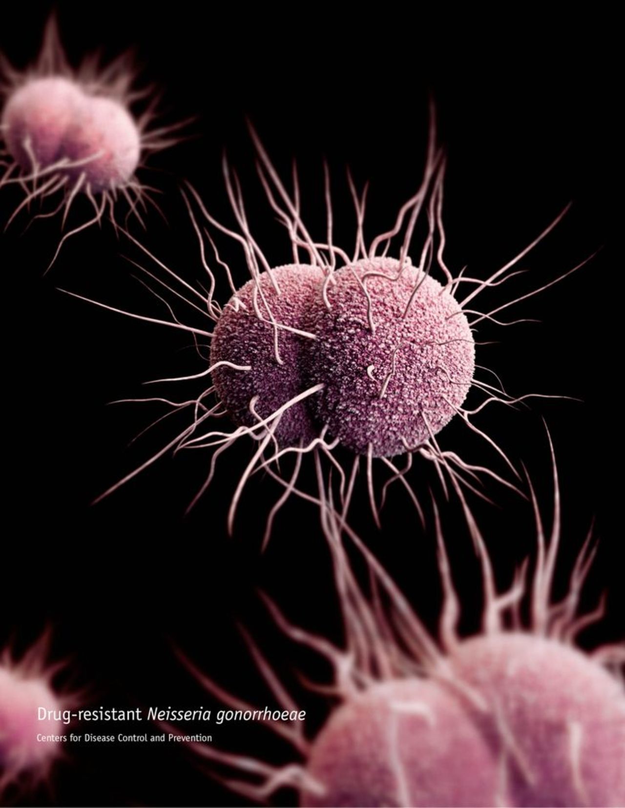 Neisseria gonorrhoeae, the bacteria that cause gonorrhea, are developing resistance to the main drugs used against them. Left untreated, gonorrhea can cause serious health problems, including pelvic inflammatory disease in women and a painful condition in the tubes attached to the testicles in men.