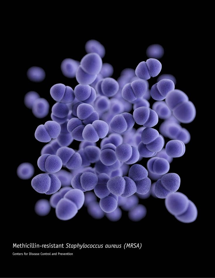Staphylococcus aureus Methicillin Resistant Invasive Disease