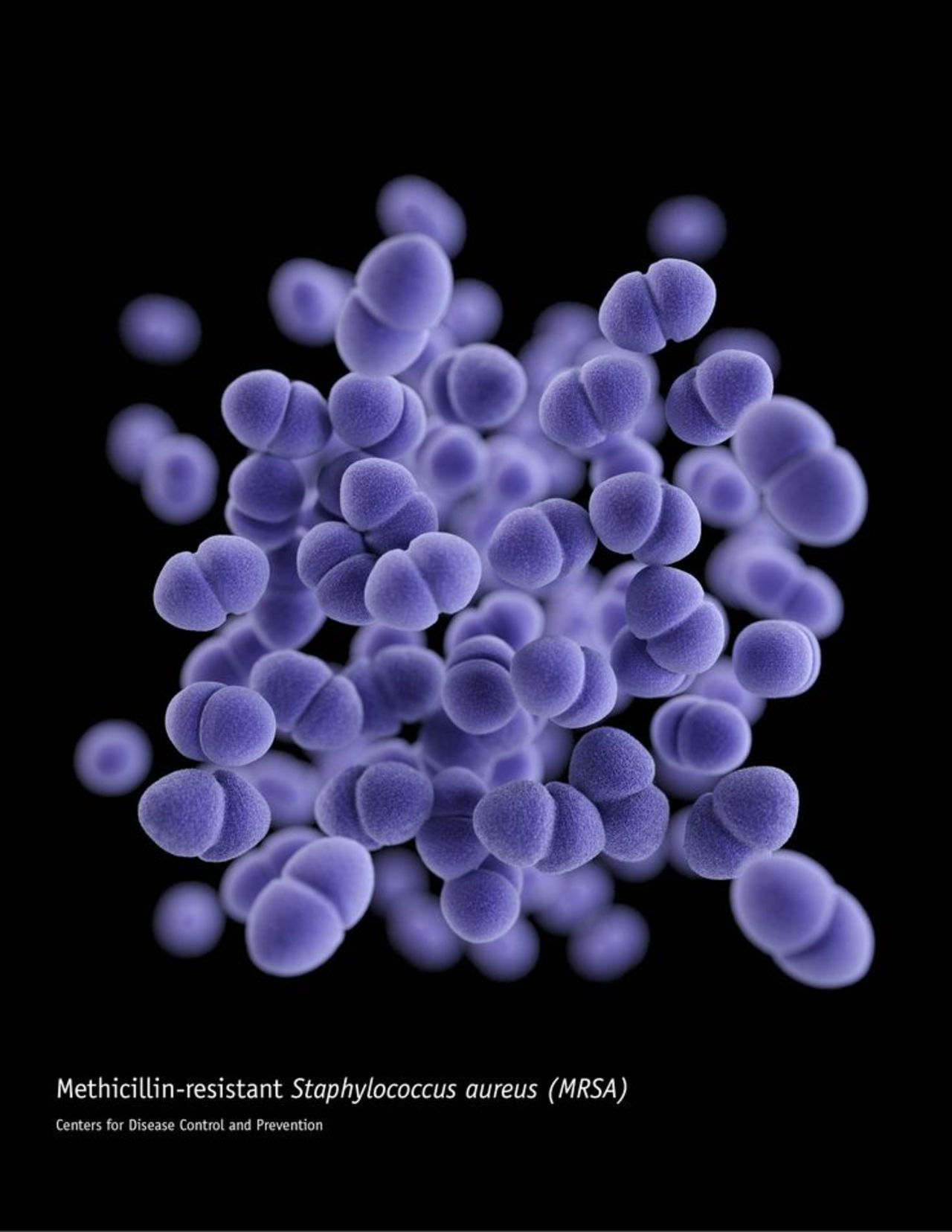 Methicillin-resistant Staphylococcus aureus (MRSA)