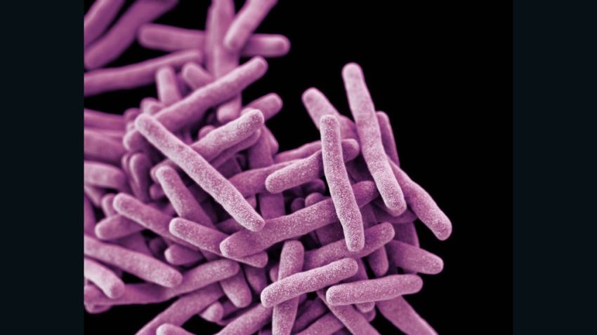 Drug-resistant tuberculosis