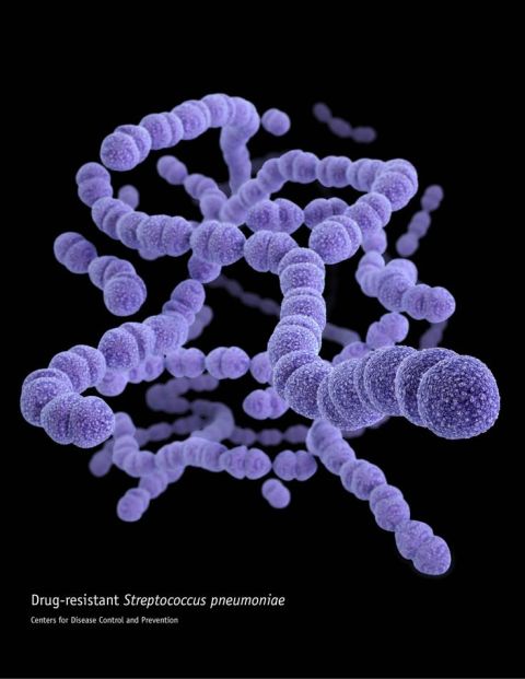 Streptococcus pneumoniae bacteria are showing resistance to penicillin. Other options remain possible to treat the infection for now, but resistance is emerging. Infection can cause a range of symptoms, including pneumonia and meningitis.