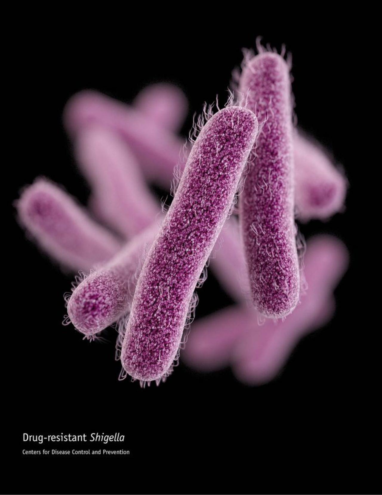 Shigella bacteria are showing resistance to fluoroquinolone and increasingly to second-line drugs used against them. They infect the intestine and cause diarrhea.