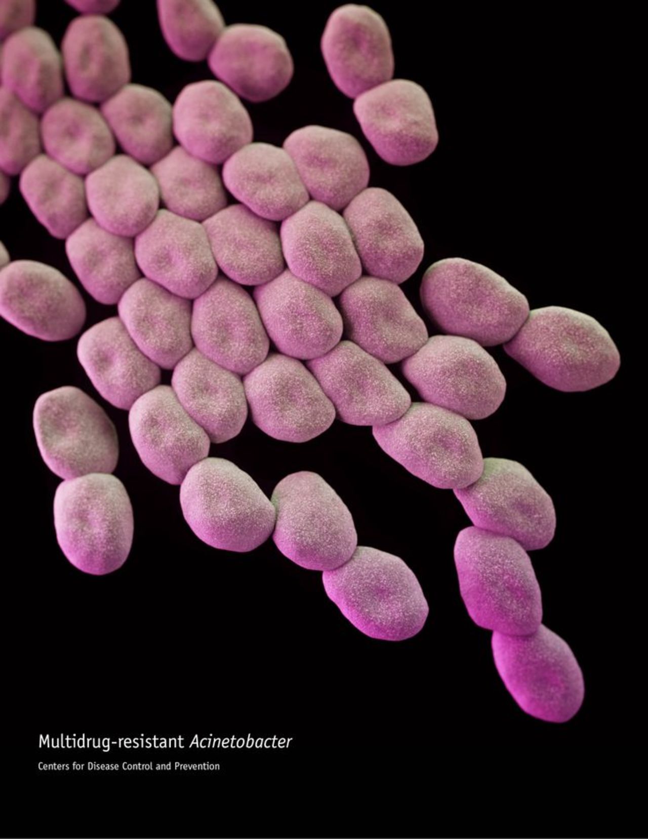 Drug-resistant Acinetobacter