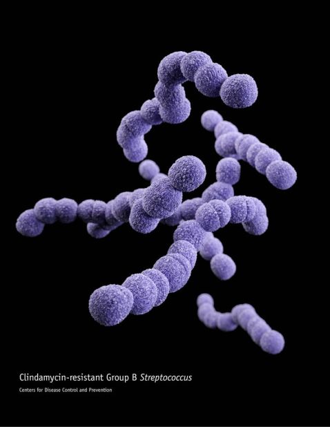 Clindamycin-resistant group B Streptococcus 
