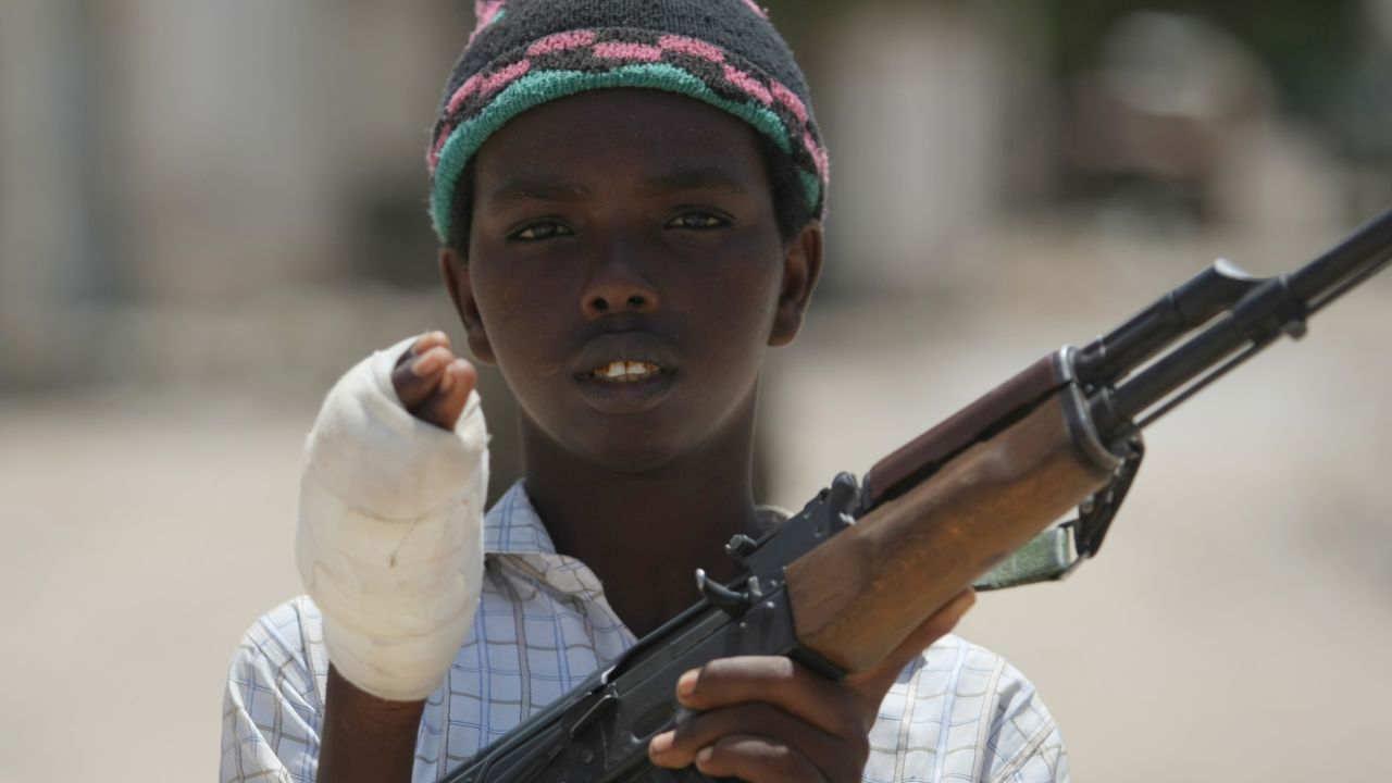 A boy belonging to Al-Shabaab shows the wound he suffered battling government forces in Mogadishu in a 2009 photo.