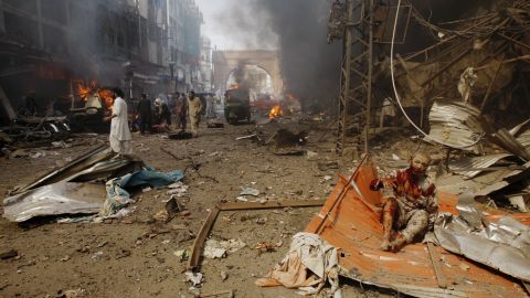 An injured man waits for help at the site of the blast.