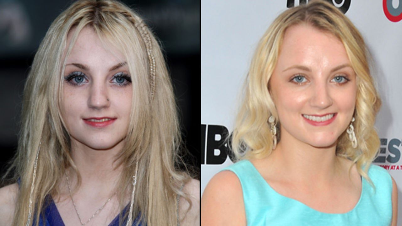 Evanna Lynch, o Luna Lovegood, apareció en la mitad de la saga de Harry Potter, pero su personaje era tan maravillosamente extraño que es una de las más memorables. Y si hay alguien que desea la llegada de las cintas spinoff, es ella: "Quizá 'Fantastic Beasts' se convertirá en algo duradero como Harry Potter y yo pueda interpretar a Luna siendo vieja", escribió en Twitter. "Incluso si soy muy vieja para interpretar a Luna, ¿puedo someterme a diez horas de maquillaje para ser un 'snorkack', por favor?".