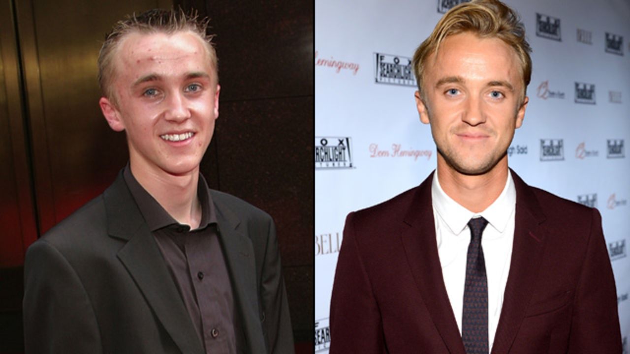 Ha pasado el tiempo suficiente para que dejemos de atemorizarnos al ver a Tom Felton, conocido como el matón de Draco Malfoy. Incluso mientras trabajaba en la saga de Potter, Felton apareció en otras cintas, como "The Disappeared" y "Get Him to the Greek". Felton ha estado ocupado desde el final de la saga del mago, y el próximo año aparecerá en en una película de la Segunda Guerra Mundial llamada "Ghosts of the Pacific".